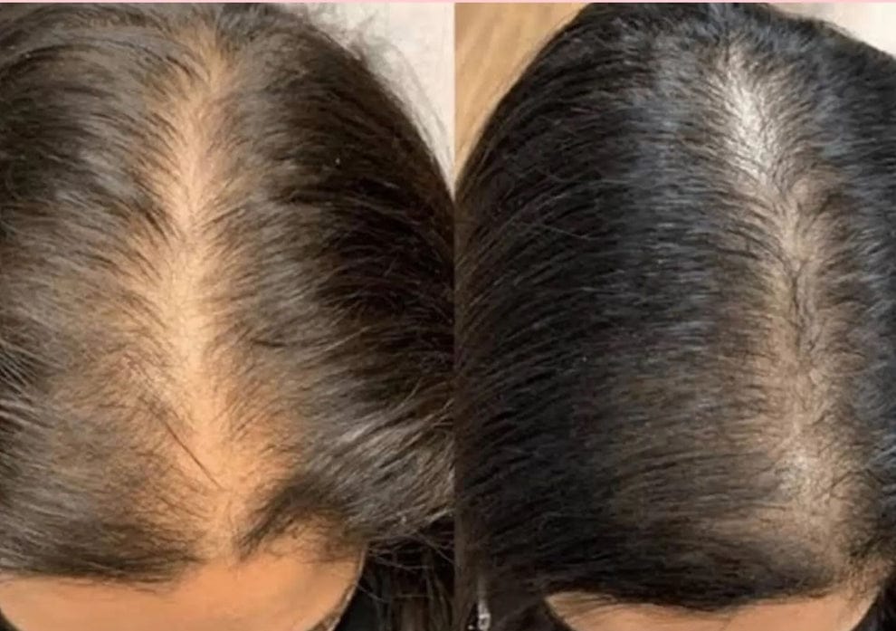 RAKHS Herbal Hair Oil