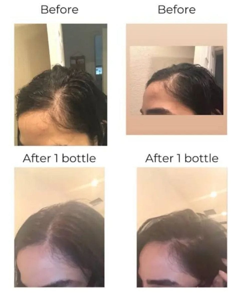 RAKHS Herbal Hair Oil