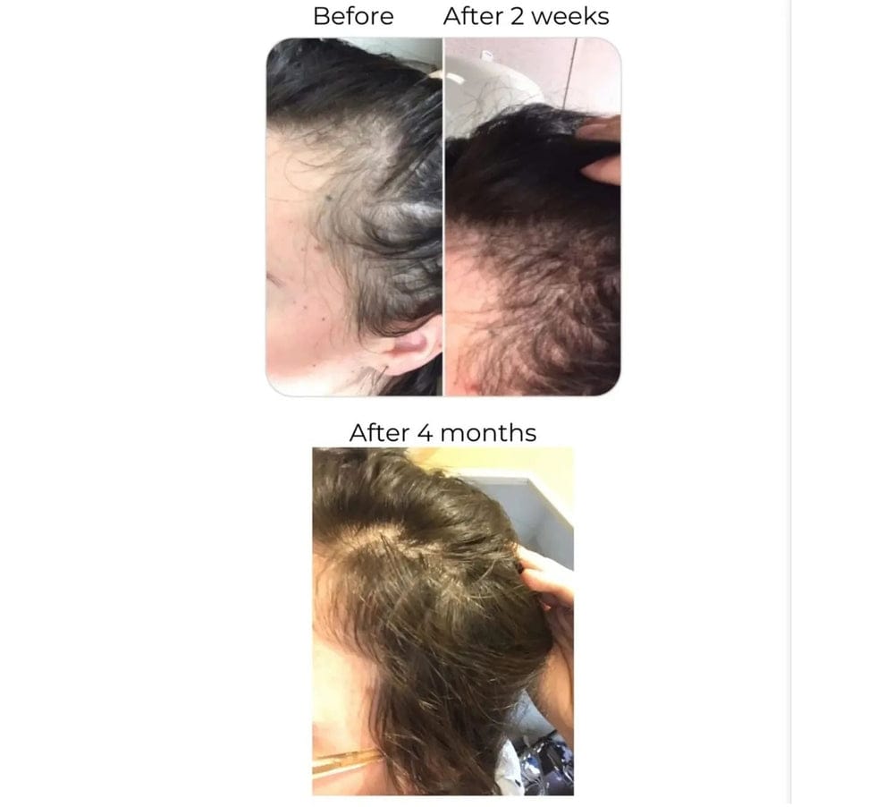 RAKHS Herbal Hair Oil