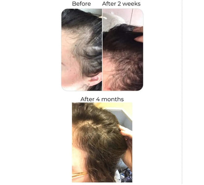 RAKHS Herbal Hair Oil