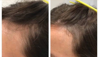 RAKHS Herbal Hair Oil